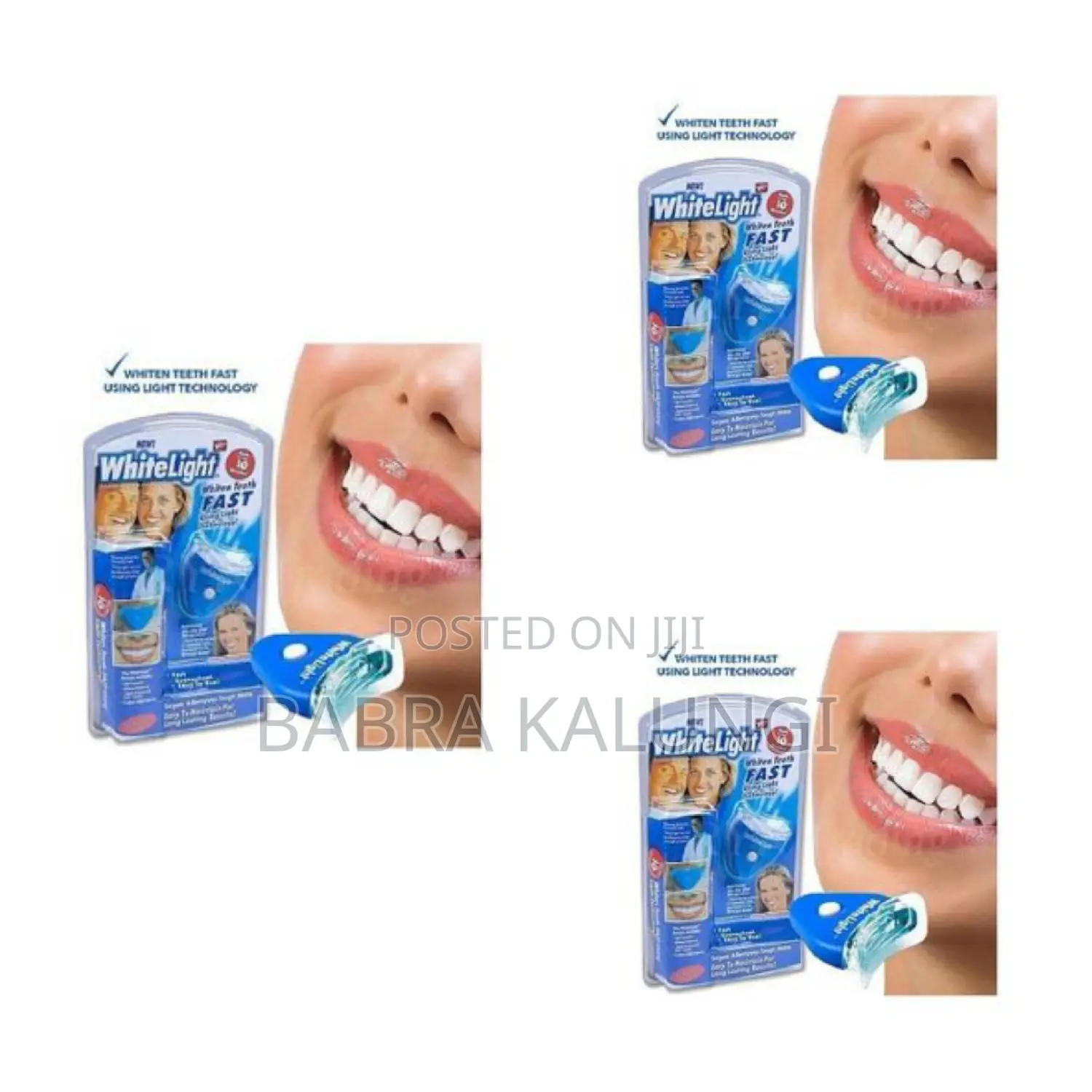 White Light Professional Teeth Whitening Kit