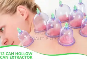Hijama Cupping Kit Cups Cupping Therapy Set.