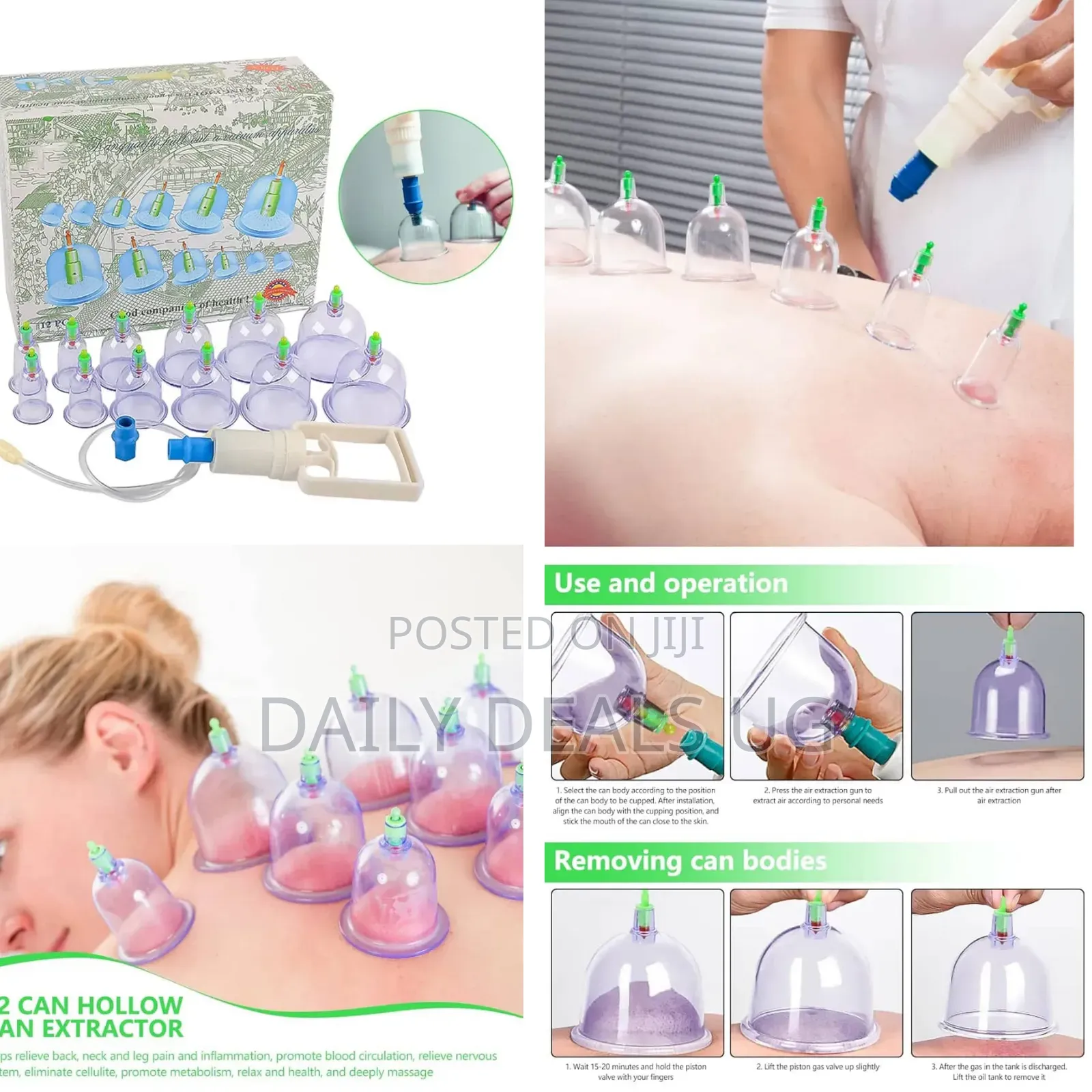 Vacuum Cupping Therapy Set