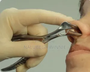 Nasal Speculum
