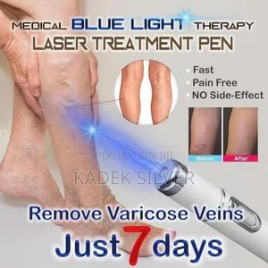 Vericose Treatment Pen 1