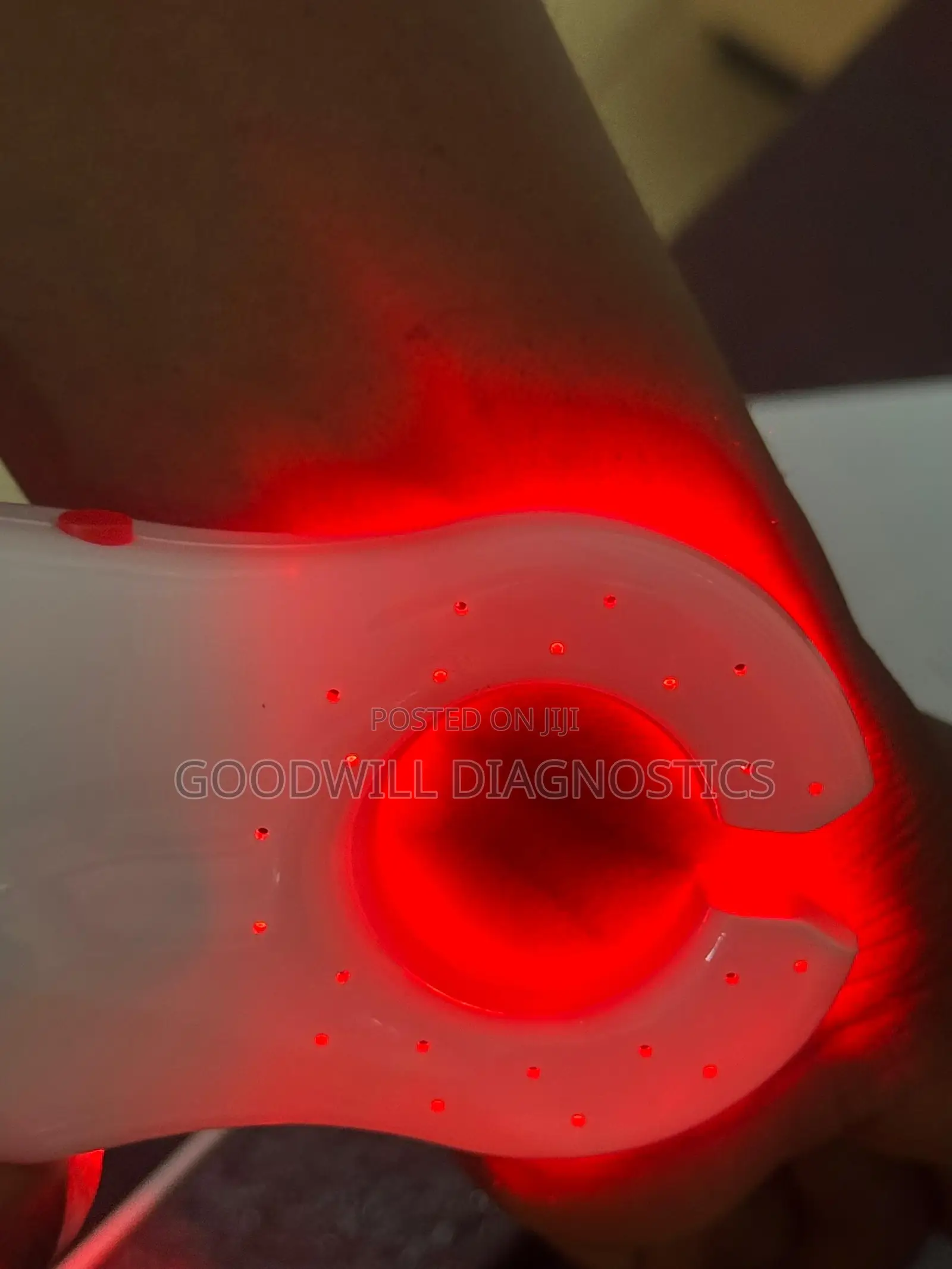 Vein Finder