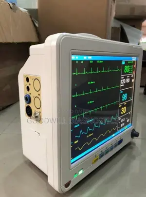 Patient Monitor With Back Up Battery
