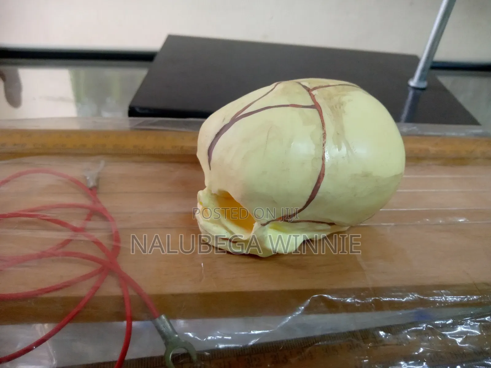 Infant Skull