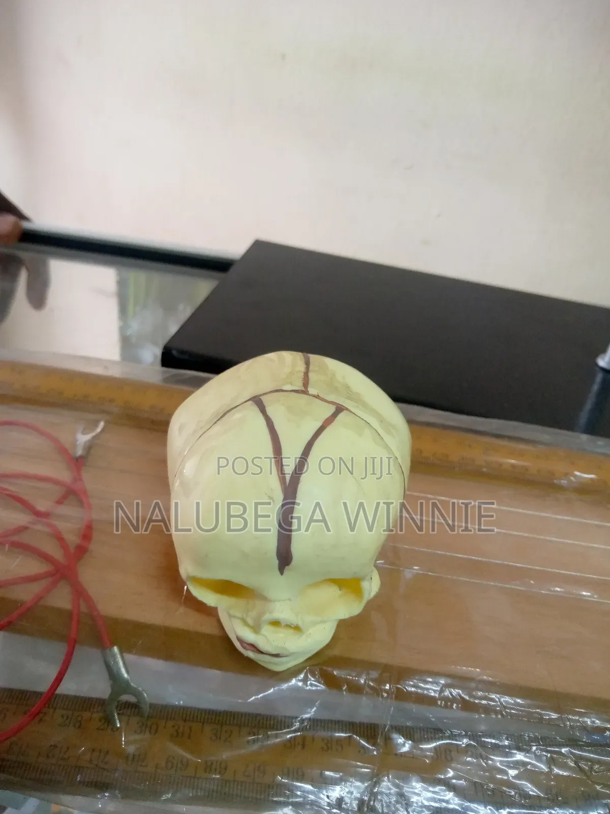 Infant Skull