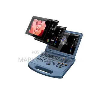 Brand New Portable High End Scan Machine With Color Doppler