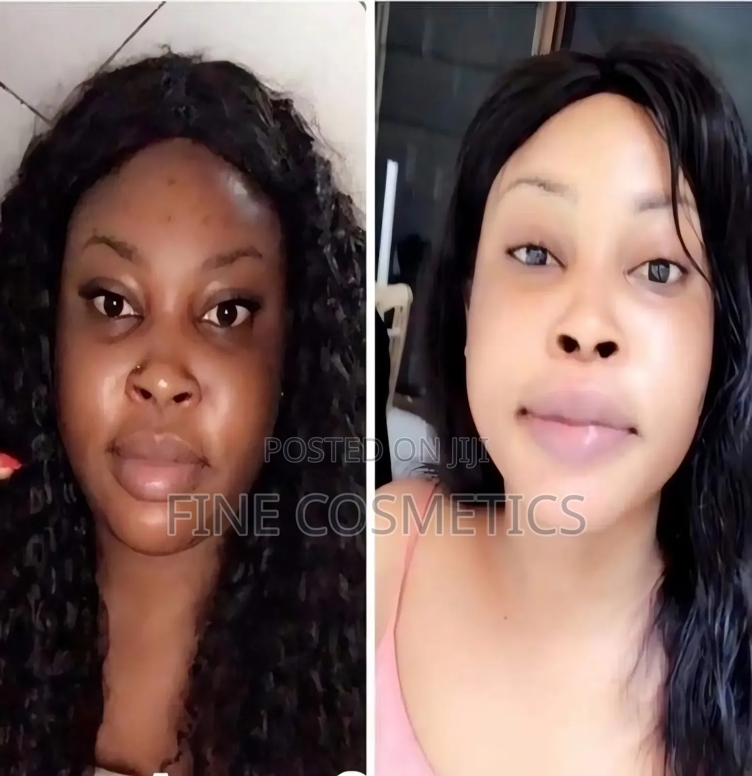 Executive Molato Soap, Vip Nigerian Super Lightening Darkspots Remover