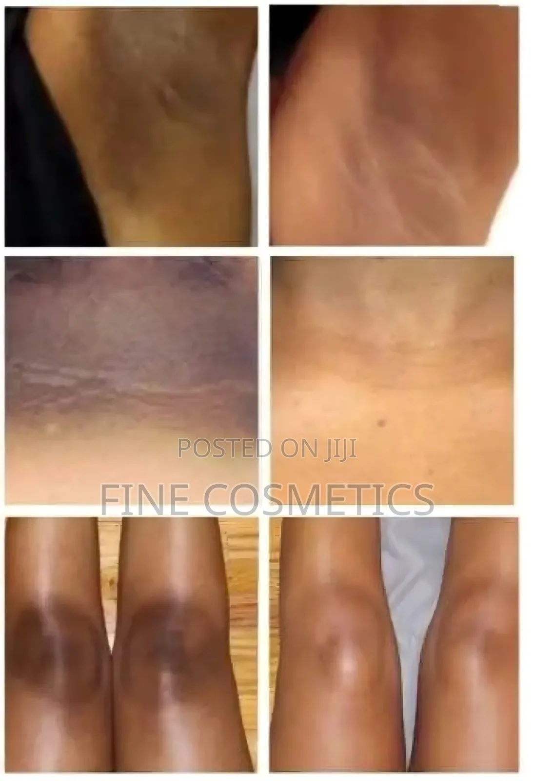Executive Molato Soap, Vip Nigerian Super Lightening Darkspots Remover