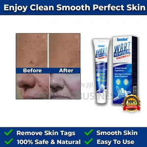 Wart Removal Cream