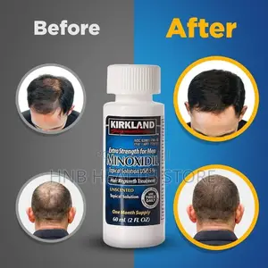 Kirkland Minoxidil Hair Growth Oil.