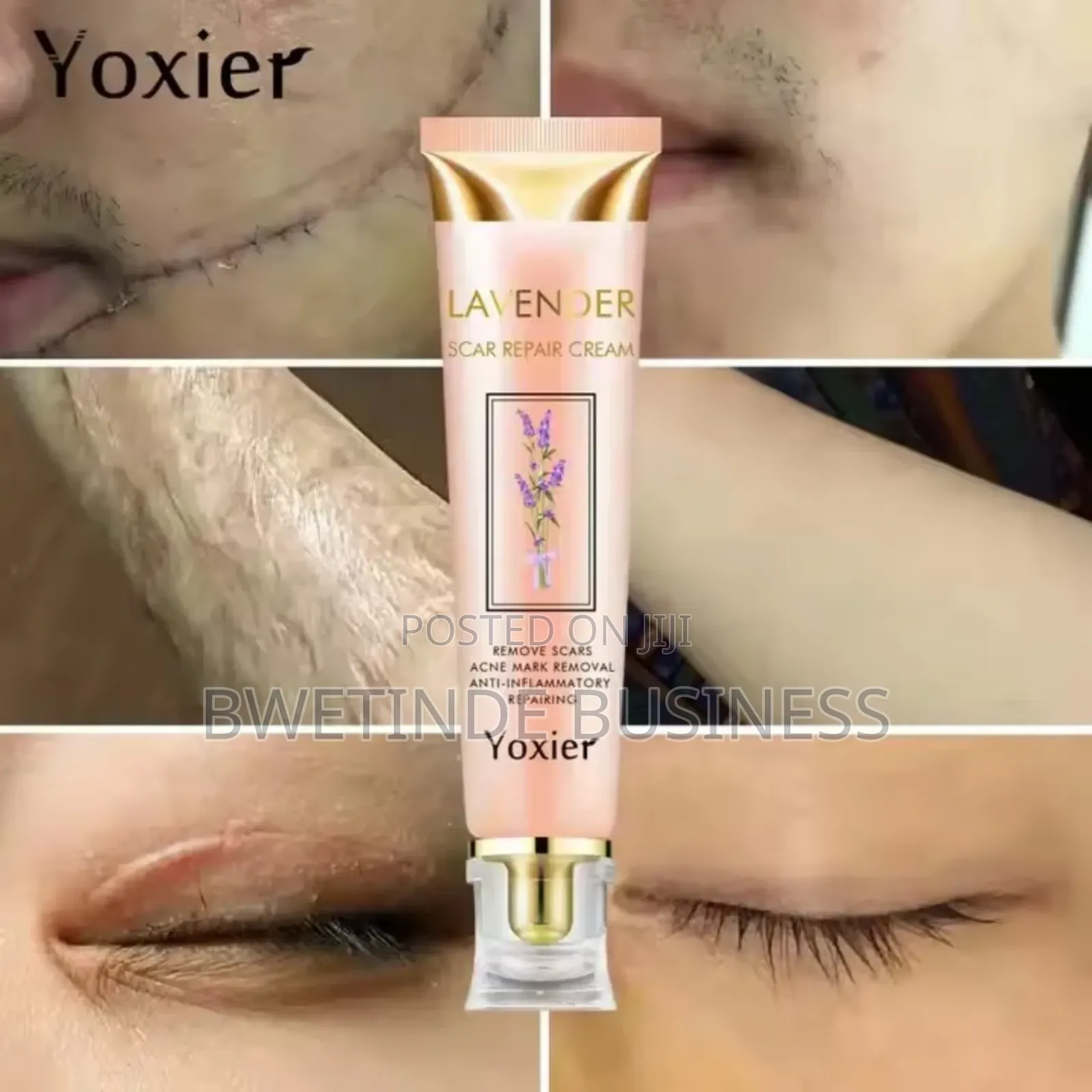 Yoxier Lavender Scar Repair Cream