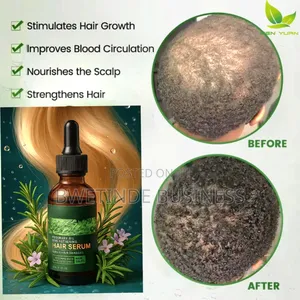 Rosemary Hair Growth Repair Serum