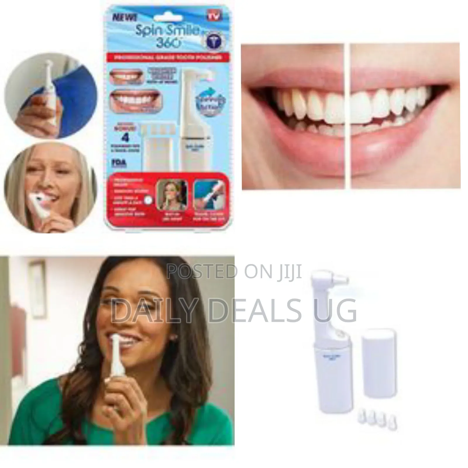 Spark Innovators Spin Smile 360 - Professional Grade Tooth Polisher