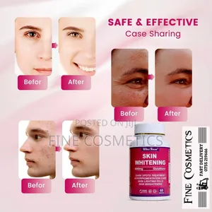 Wholesale Only, Skin Whitening Tablets Glutathione Darkspots Tablets
