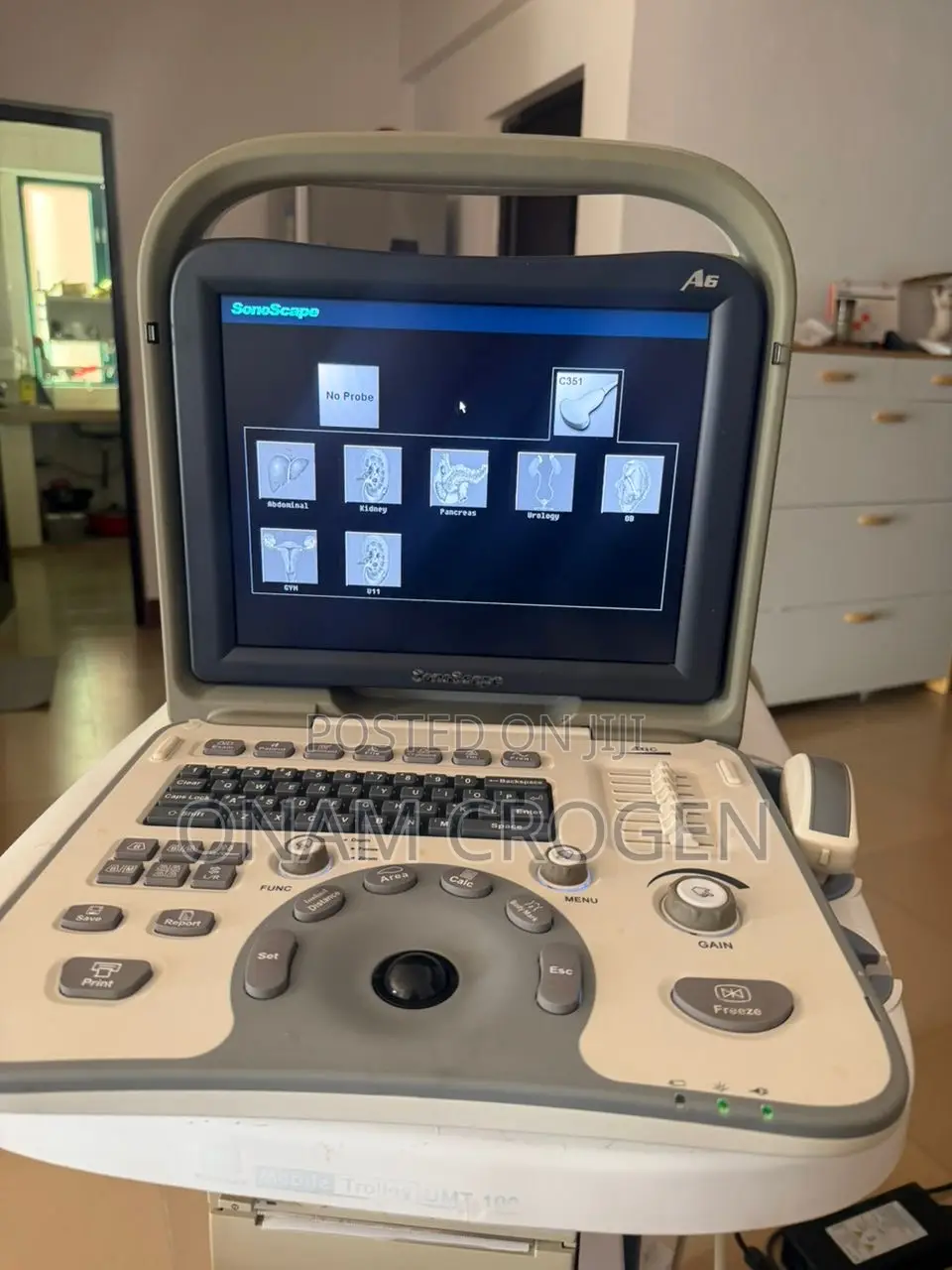 Sonoscape Ultrasound A6