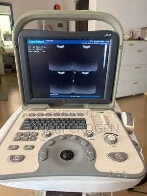 Sonoscape Ultrasound A6