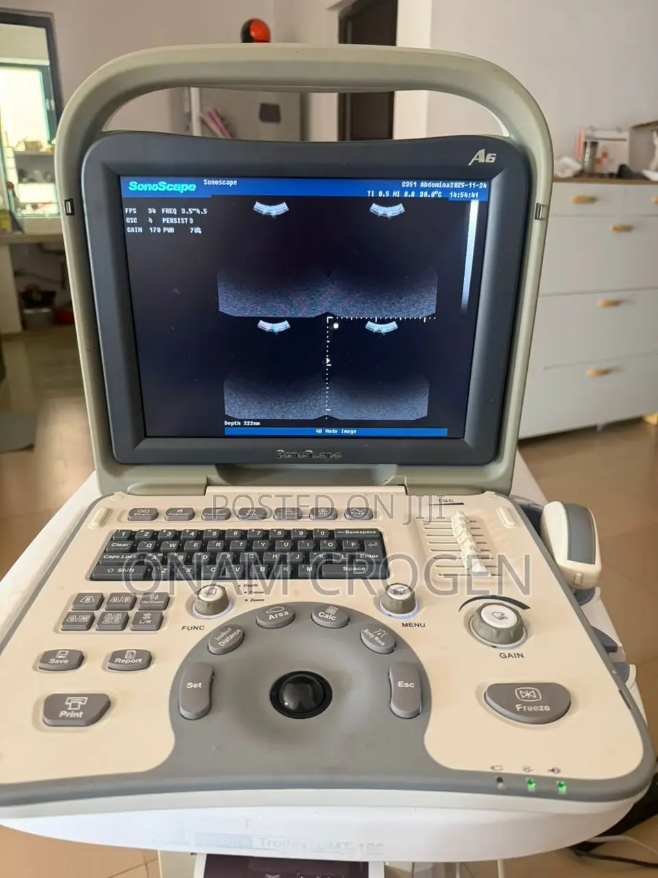 Sonoscape Ultrasound A6