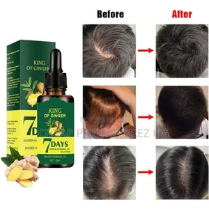 Natural Ginger Hair Growth and Anti-Hair Loss Solution