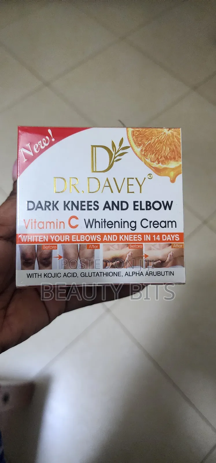 Dark Knees and Elbows Whitening Cream