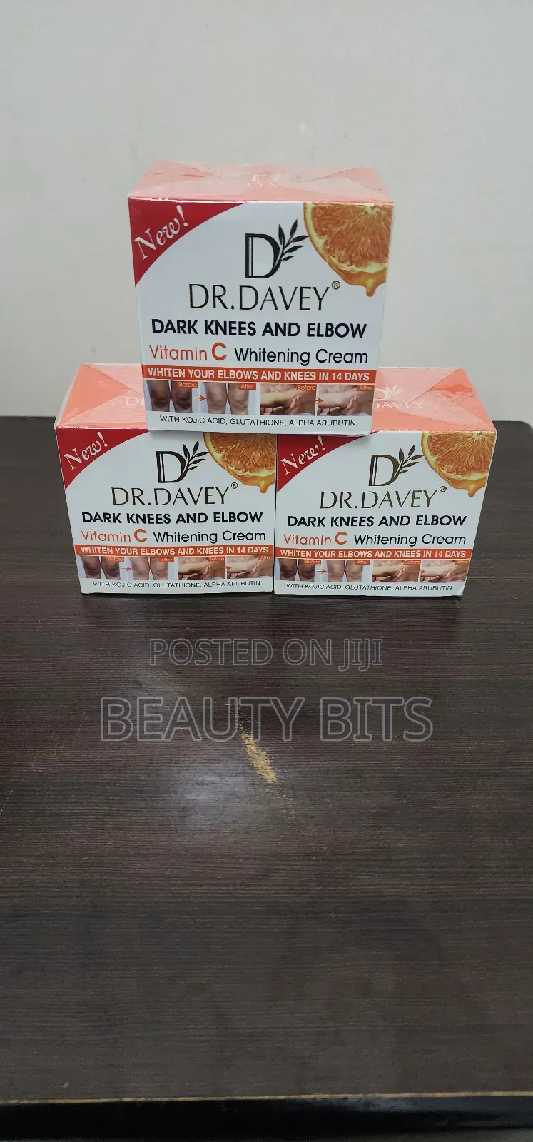 Dark Knees and Elbows Whitening Cream