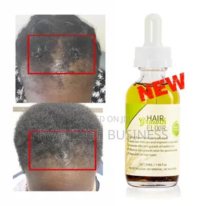 Syulli Hair Growth Elixir Oil.