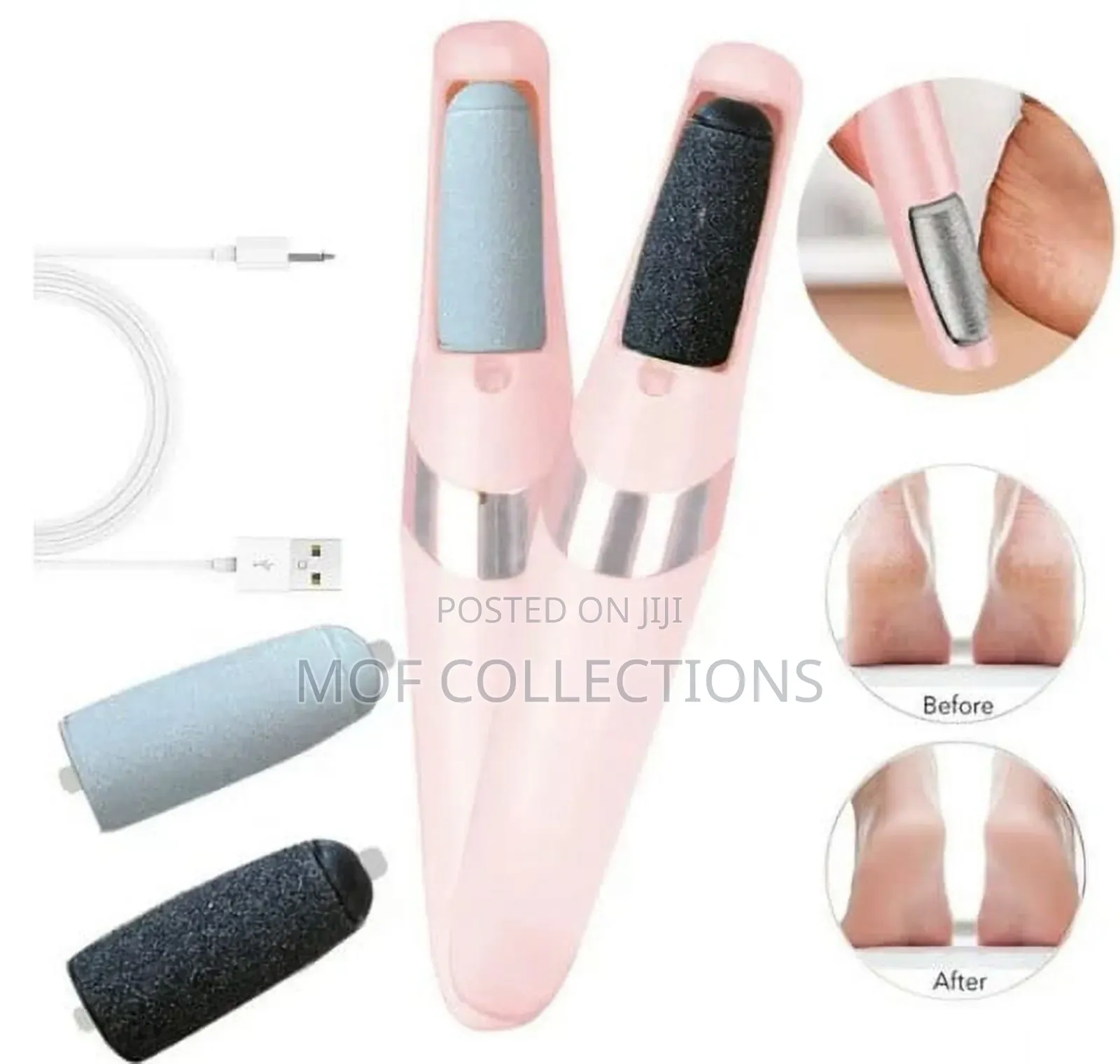 Callus Remover Foot File