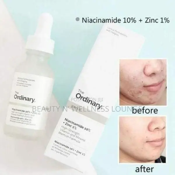 The Ordinary Niacinamide + Zinc Serum