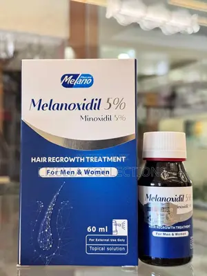 Minoxidil 5% (No Hereditary Baldness, Hair Loss, Alopecia