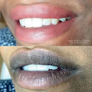 Pink Lips Therapy