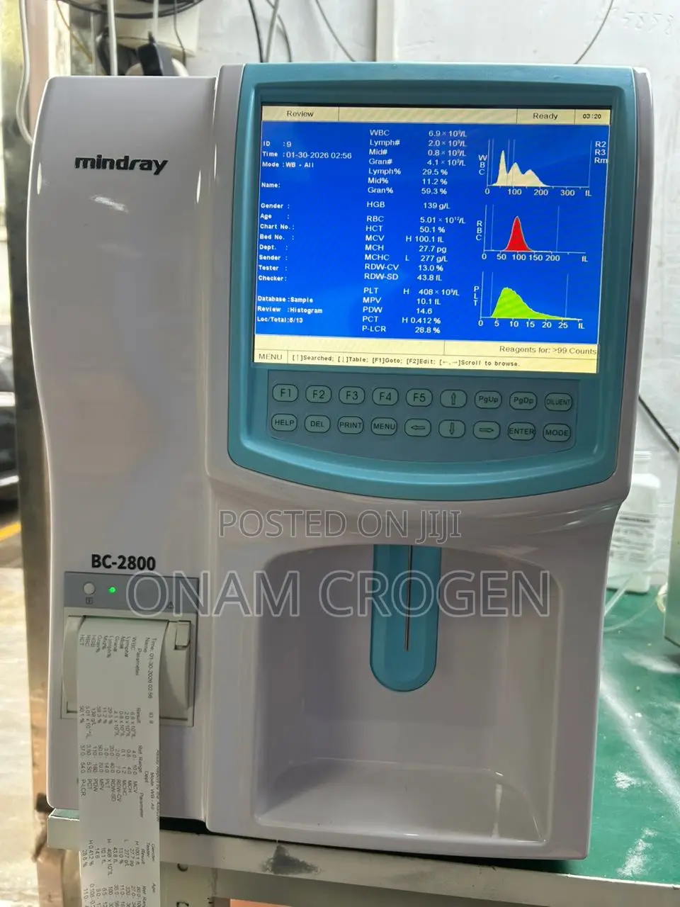 CBC Machine(3 Part Mindray Bc 2800)