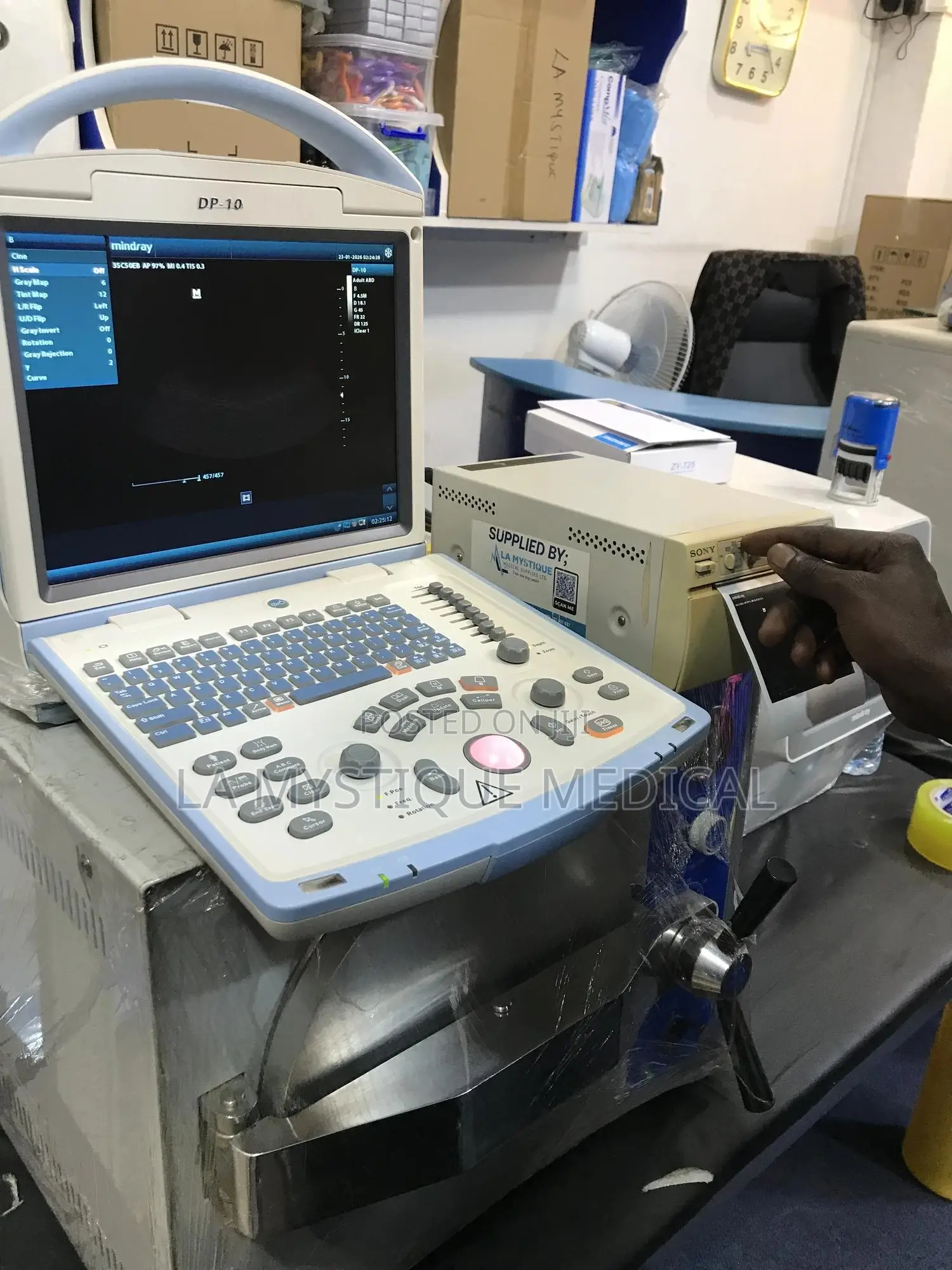 Mindray Dp10 Ultrasound With a Printer