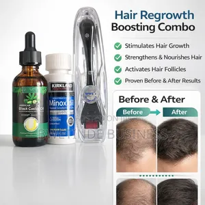 Hair Regrowth Combo: Minoxidil 5%, Castor Oil Derma Roller