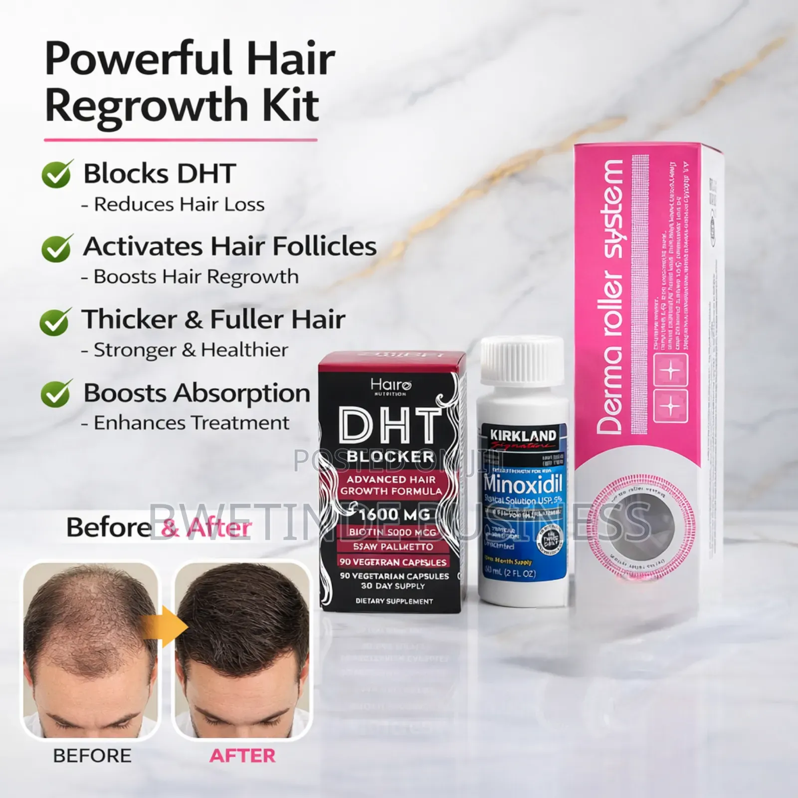 Minoxidil 5% Hair Growth Kit + DHT Blocker + Derma Roller