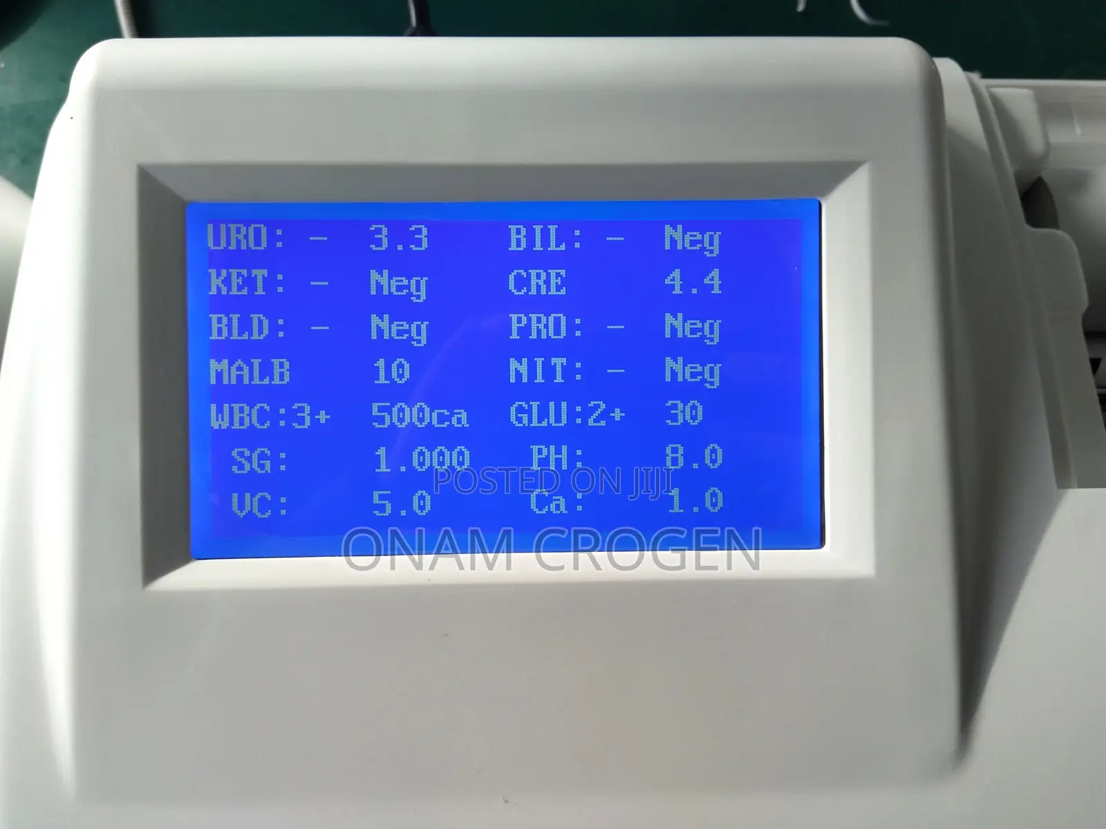 Urine Analyser
