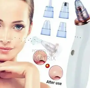 Electric Plastic Pores Cleaner
