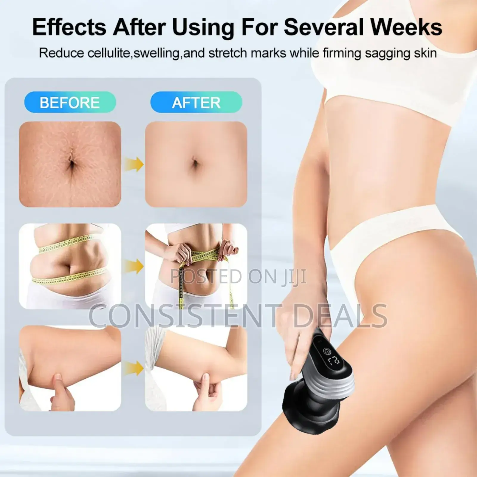 Electric  Anti Cellulite Massager