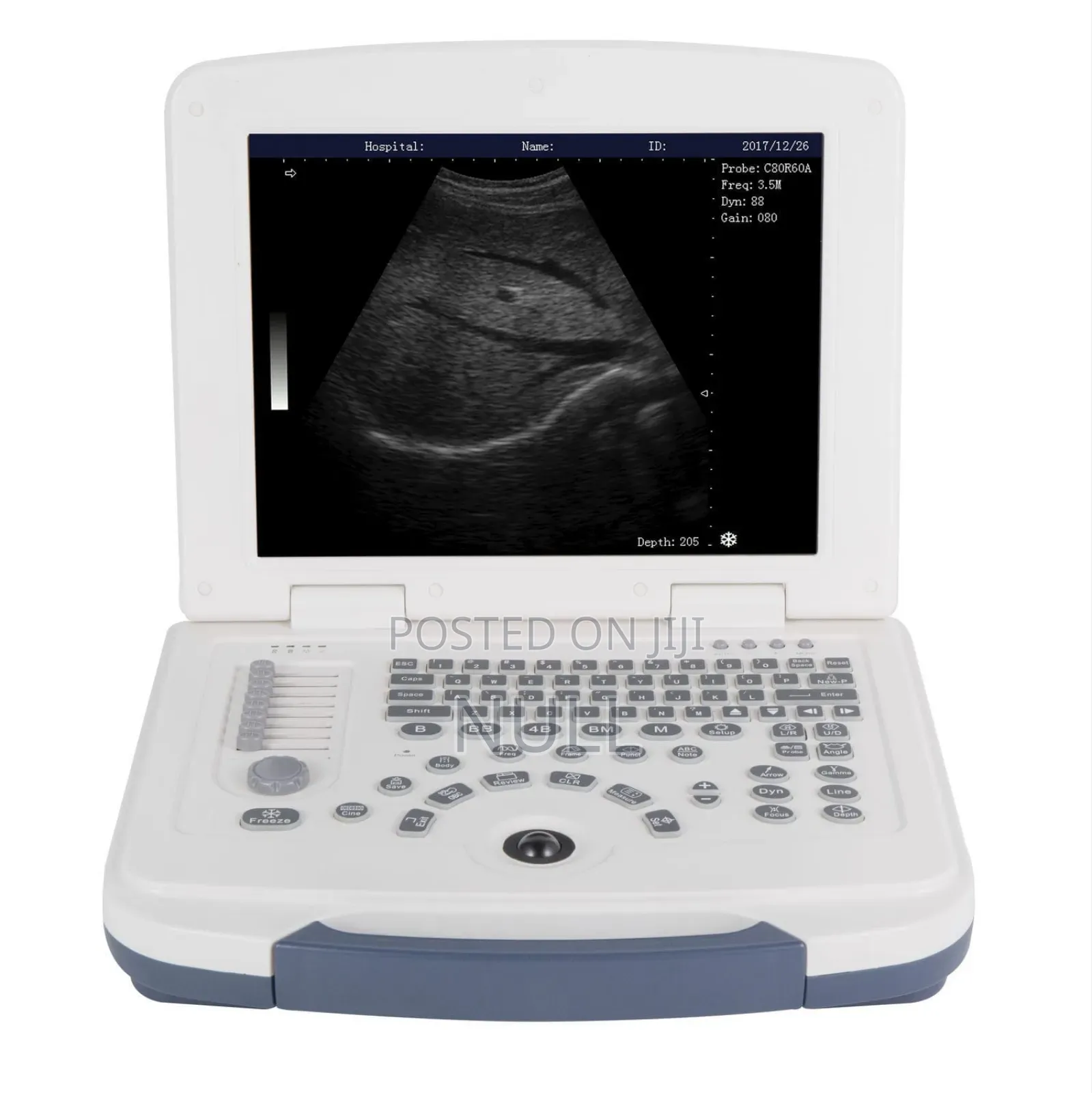 Ultra Sound Machine