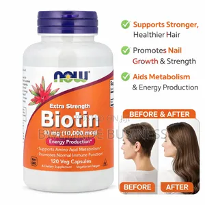 Now Foods Extra Strength Biotin 10,000mcg – Hair, Skin Supplement