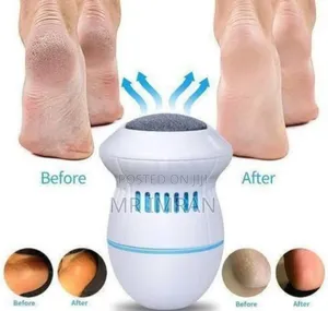 Electric Foot Callus Remover