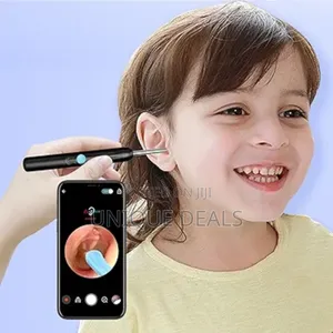 Ear Wax Removal - Ear Cleaner With Camera