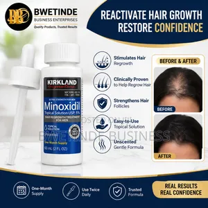 Beard and Hairline Regrowth Oil- Kirkland Minoxidil Solution