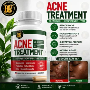 Acne Treatment Capsules Dark Spots