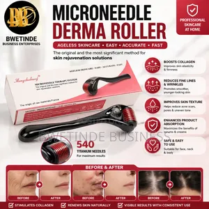 Derma Roller 540 Needles – Beard, Hair Growth Skin Care Tool