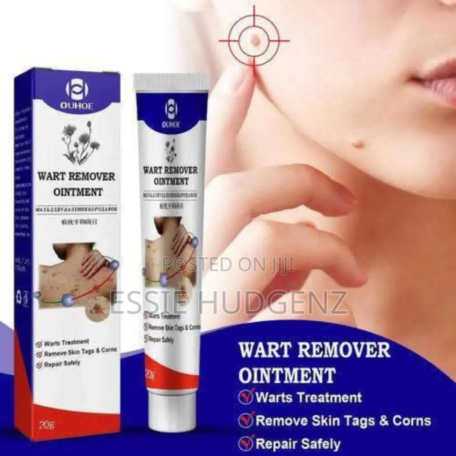 Warts Skin Tags Remover Original