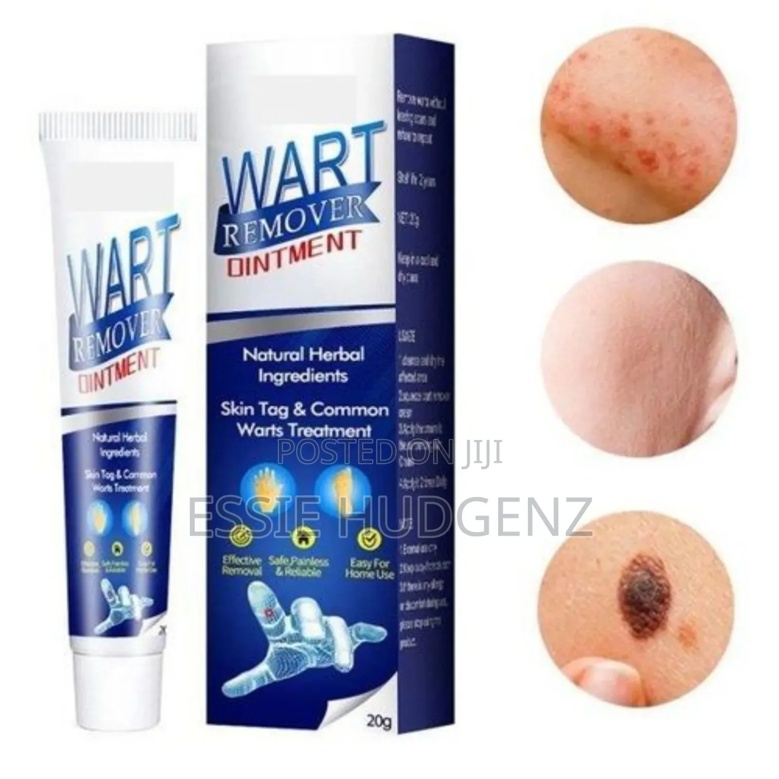 Warts Skin Tags Remover Original