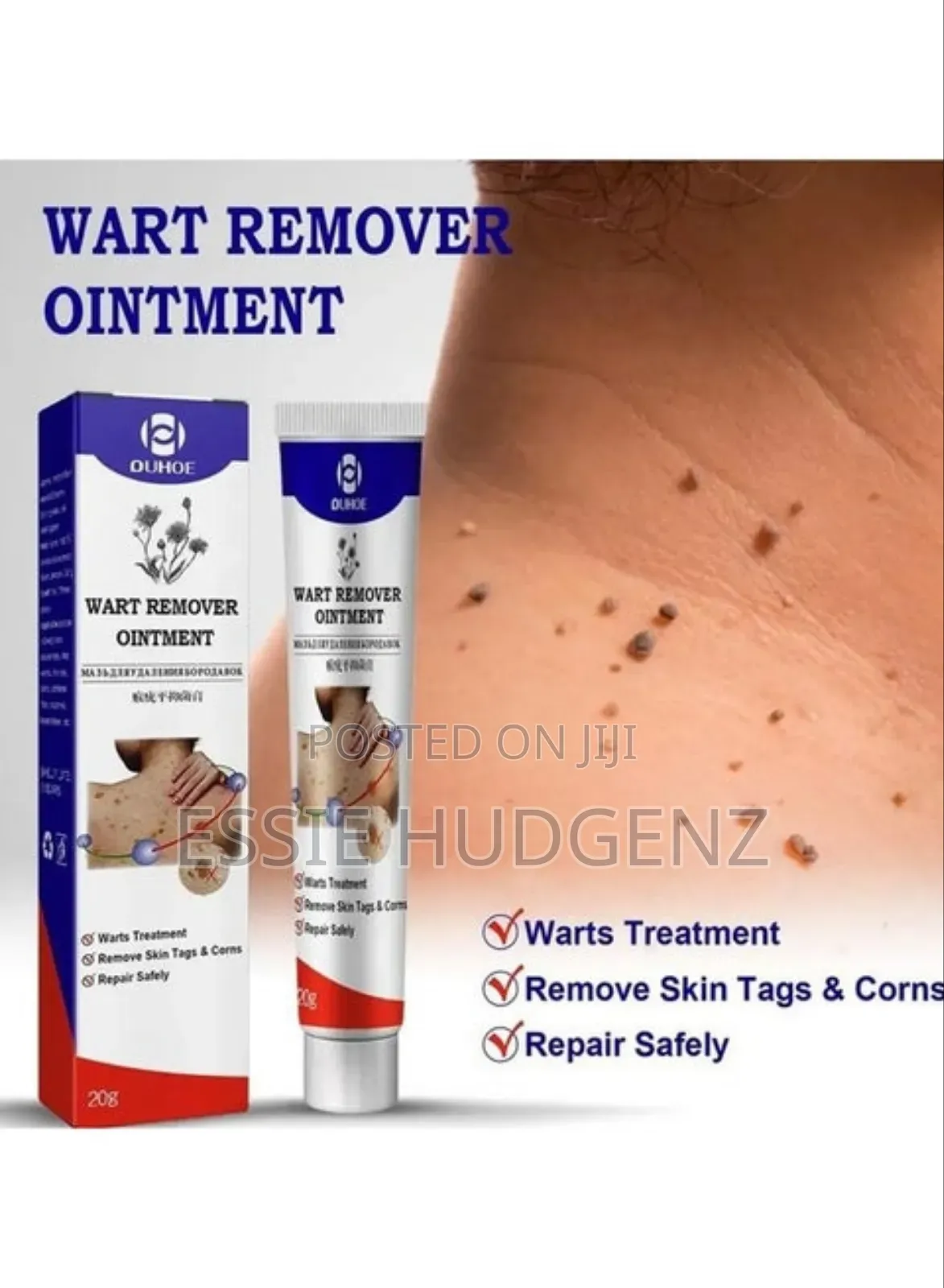 Warts Skin Tags Remover Original