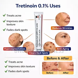 Tretinoin 0.1% for Wrinkles, Stretch Marks and Acne