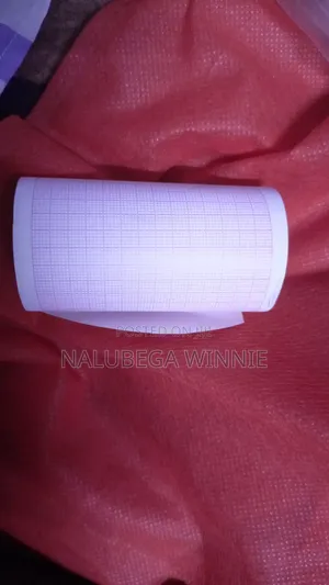Ecg Papers/ Electrocardiogram Papers