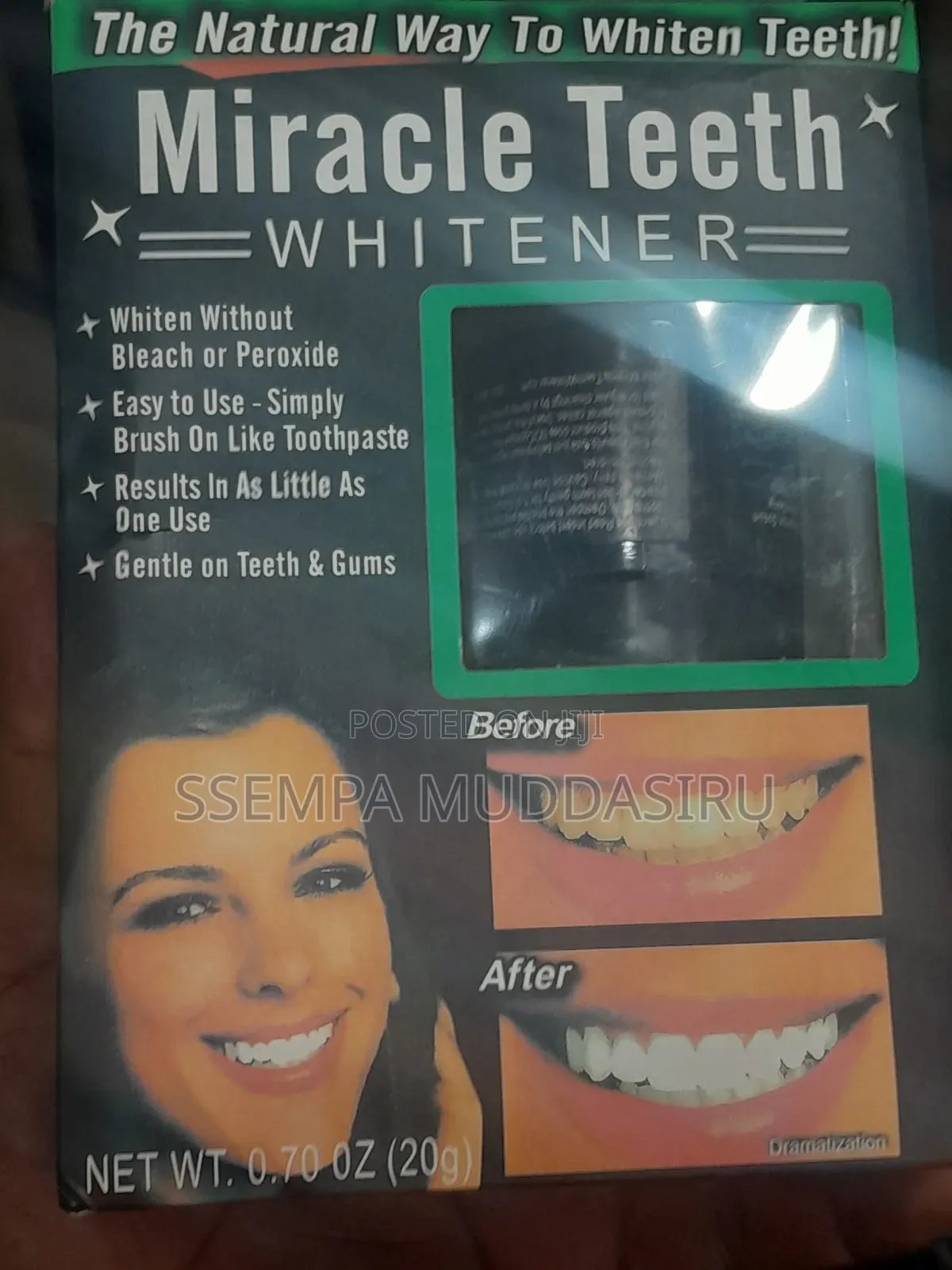 Miracle Teeth Whitener 20g