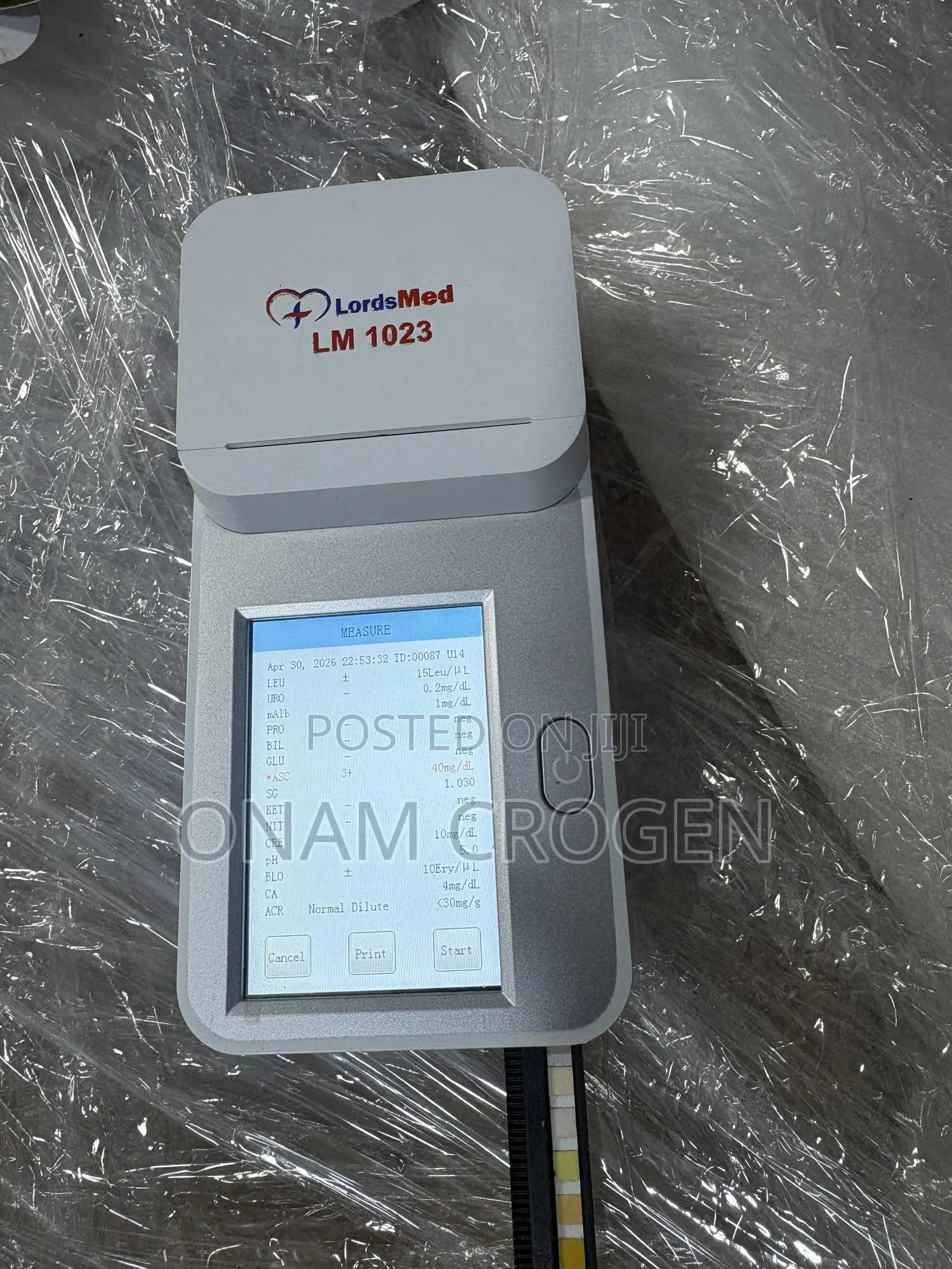 Urine Analyser (Lordsmed)